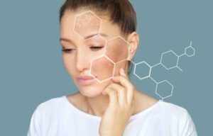does iron deficiency cause melasma